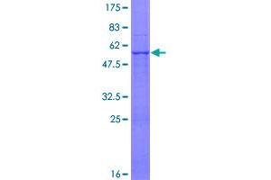 Image no. 1 for ATP Synthase, H+ Transporting, Mitochondrial Fo Complex, Subunit B1 (ATP5F1) (AA 1-256) protein (GST tag) (ABIN1346058)