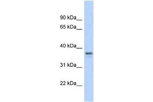 WB Suggested Anti-GAPDH Antibody Titration: 0. (GAPDH anticorps  (Middle Region))