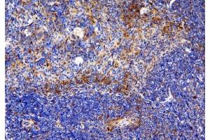 IHC analysis of CCR6 using anti-CCR6 antibody (ABIN7603110). (CCR6 anticorps  (N-Term))