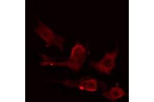 ABIN6275224 staining HuvEc cells by IF/ICC. (MIA2 anticorps  (C-Term))
