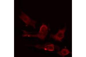ABIN6275224 staining HuvEc cells by IF/ICC. (MIA2 anticorps  (C-Term))