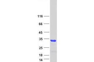 Validation with Western Blot