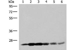 Western blot analysis of 293T cell lysates using GSTK1 Polyclonal Antibody at dilution of 1:250 (GSTK1 anticorps)