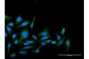 Immunofluorescence of purified MaxPab antibody to PPP1R2 on HeLa cell.