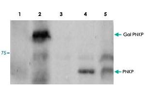 Western blot using PNKP polyclonal antibody  shows detection of a 57 kDa band corresponding to : Lane 1, human PNKP in a Y190 yeast cell lysate. (PNKP anticorps  (Internal Region))