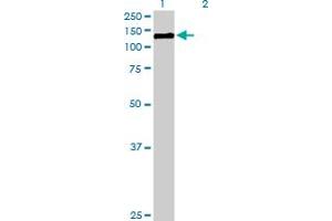 Western Blot analysis of CDH3 expression in transfected 293T cell line by CDH3 MaxPab polyclonal antibody.