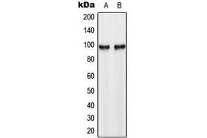 Western blot analysis of Hexokinase 3 expression in HL60 (A), HeLa (B) whole cell lysates. (HK3 anticorps  (C-Term))