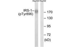 Western blot analysis of extracts from HepG2 cells treated with Na3VO4 0. (IRS1 anticorps  (pTyr896))