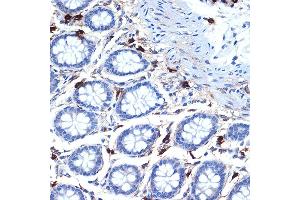 Immunohistochemistry of paraffin-embedded human colon using Mast Cell Tryptase (TPSB2) (TPSB2) Rabbit mAb (ABIN7271017) at dilution of 1:100 (40x lens). (TPSB2 anticorps)
