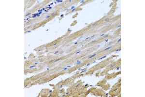 Immunohistochemistry of paraffin-embedded rat heart using NSF antibody (ABIN5974702) at dilution of 1/100 (40x lens). (NSF anticorps)