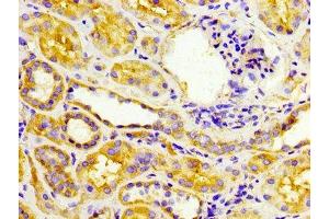IHC image of ABIN7151941 diluted at 1:300 and staining in paraffin-embedded human kidney tissue performed on a Leica BondTM system.