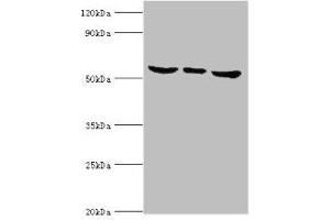 Western blot All lanes: MAPK15 antibody at 6 μg/mL Lane 1: Hela whole cell lysate Lane 2: MCF-7 whole cell lysate Lane 3: HepG2 whole cell lysate Secondary Goat polyclonal to rabbit IgG at 1/10000 dilution Predicted band size: 60, 29, 32 kDa Observed band size: 60 kDa