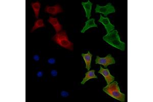 ABIN6257016 and ABIN6274443 staining Hela cells by IF/ICC. (EPS8-Like 1 anticorps  (Internal Region))
