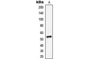 Western blot analysis of CD85i expression in MCF7 (A) whole cell lysates. (LILRA1 anticorps  (Center))