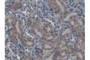 DAB staining on IHC-P; Samples: Mouse Kidney Tissue