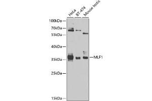 Western blot analysis of extracts of various cell lines, using MLF1 antibody (ABIN6128238, ABIN6143875, ABIN6143877 and ABIN6224035) at 1:1000 dilution. (MLF1 anticorps  (AA 1-268))