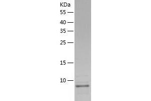 Western Blotting (WB) image for Betacellulin (BTC) (AA 32-111) protein (His tag) (ABIN7122001) (Betacellulin Protein (BTC) (AA 32-111) (His tag))