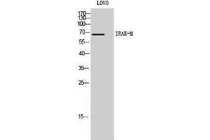 Western Blotting (WB) image for anti-Interleukin-1 Receptor-Associated Kinase 3 (IRAK3) (C-Term) antibody (ABIN3185224)