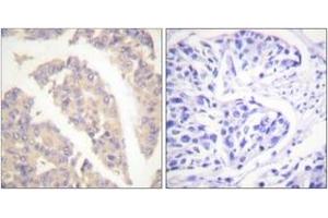 Immunohistochemistry (IHC) image for anti-Cas-Br-M (Murine) Ecotropic Retroviral Transforming Sequence (CBL) (AA 666-715) antibody (ABIN2888651) (CBL anticorps  (AA 666-715))