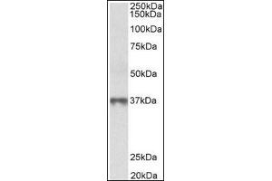 MAT2B  Antibody staining of Human Thymus lysate at 0. (MAT2B anticorps  (Isoform 1, N-Term))