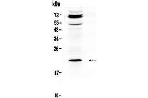 Western blot analysis of C19orf80 using anti-C19orf80 antibody . (C19ORF80 anticorps  (AA 22-198))