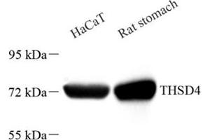 Western blot analysis of THSD4 (ABIN7075894),at dilution of 1: 2000 (Thrombospondin, Type I, Domain Containing 4 (THSD4) anticorps)
