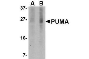 Western Blotting (WB) image for anti-BCL2 Binding Component 3 (BBC3) (AA 76-170) antibody (ABIN492518) (PUMA anticorps  (AA 76-170))
