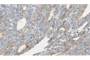 ABIN6268945 at 1/100 staining Human prostate tissue by IHC-P.