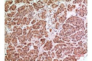 Immunohistochemistry (IHC) analysis of paraffin-embedded Human Pancreas, antibody was diluted at 1:100.