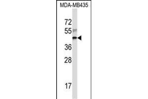 RPL3 Antibody (Center) (ABIN657323 and ABIN2846397) western blot analysis in MDA-M cell line lysates (35 μg/lane). (RPL3 anticorps  (AA 224-251))