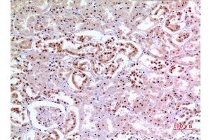 Immunohistochemistry (IHC) analysis of paraffin-embedded Human Kidney, antibody was diluted at 1:100. (XRCC6 anticorps  (Ser404))