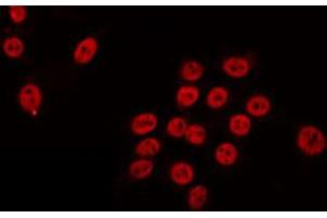 ABIN6274702 staining HeLa by IF/ICC. (RAD54L anticorps  (C-Term))