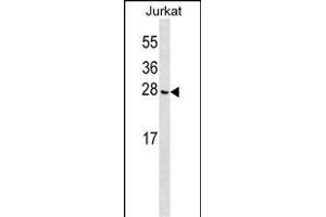 CGGBP1 Antibody (C-term) (ABIN1536689 and ABIN2849923) western blot analysis in Jurkat cell line lysates (35 μg/lane). (CGGBP1 anticorps  (C-Term))