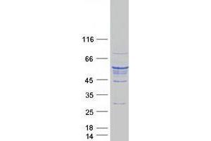 Validation with Western Blot