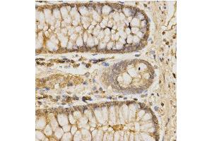Immunohistochemistry of paraffin-embedded human colon using GLB1 antibody at dilution of 1:200 (x400 lens) (GLB1 anticorps  (AA 1-270))