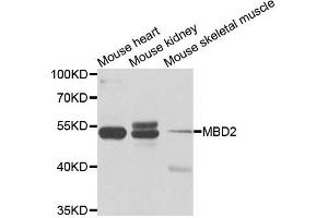 Western blot analysis of extracts of various cell lines, using MBD2 antibody. (MBD2 anticorps)