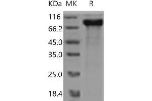 Western Blotting (WB) image for V-Erb-A erythroblastic Leukemia Viral Oncogene Homolog 4 (Avian) (ERBB4) (Active) protein (His tag) (ABIN7321212) (ERBB4 Protein (His tag))