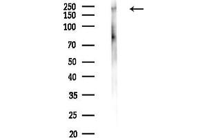anti-Insulin Receptor beta (ISR-beta) (pTyr1361) antibody