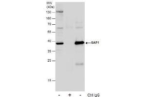 IP Image Immunoprecipitation of SAE1 protein from HepG2 whole cell extracts using 5 μg of SAE1 antibody, Western blot analysis was performed using SAE1 antibody, EasyBlot anti-Rabbit IgG  was used as a secondary reagent.
