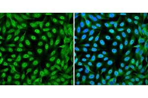 Immunofluorescence analysis of DLD-1 cells showing nuclear and cytoplasmic localization with YAP1 antibody 1:200 (left,green). (YAP1 anticorps)