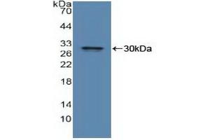 Western blot analysis of recombinant Human IDE. (IDE anticorps  (AA 753-973))