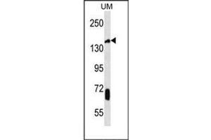 Western blot analysis of JHDM2a Antibody (C-term) in UM cell line lysates (35ug/lane). (KDM3A anticorps  (C-Term))