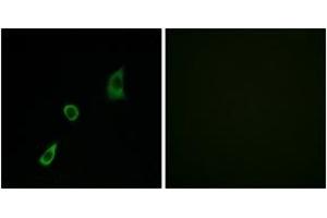 Immunofluorescence analysis of HuvEc cells, using FGF23 Antibody. (FGF23 anticorps  (AA 151-200))
