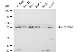 Western blotting analysis using SLC6A5 antibody (ABIN7800399).