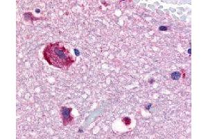 Immunohistochemical (Formalin/PFA-fixed paraffin-embedded sections) staining in human brain (caudate) with GPR61 polyclonal antibody . (GPR61 anticorps)