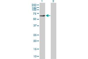 Western Blot analysis of RIPK2 expression in transfected 293T cell line by RIPK2 MaxPab polyclonal antibody. (RIPK2 anticorps  (AA 1-540))