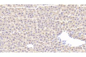 Detection of SLC in Rat Liver Tissue using Polyclonal Antibody to Secondary Lymphoid Tissue Chemokine (SLC)