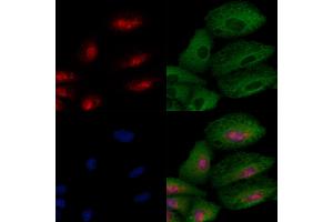 ABIN6257244 and ABIN6274448 staining  cells by IF/ICC.