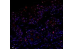 Immunofluorescence of paraffin embedded mouse skin using notch3 (ABIN7074862) at dilution of 1:650 (400x lens) (NOTCH3 anticorps)