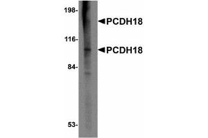 Image no. 1 for anti-Protocadherin 12 (PCDH12) (N-Term) antibody (ABIN478055) (PCDH12 anticorps  (N-Term))